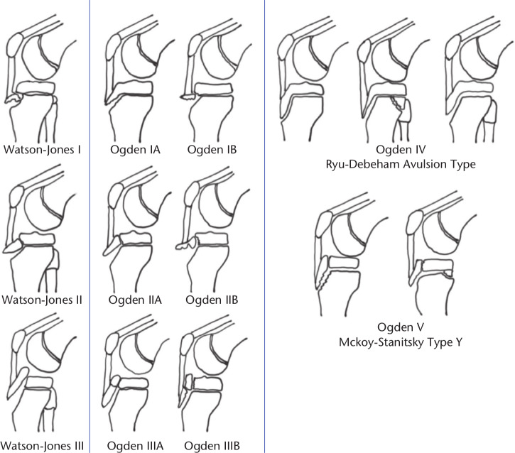 Fig. 10