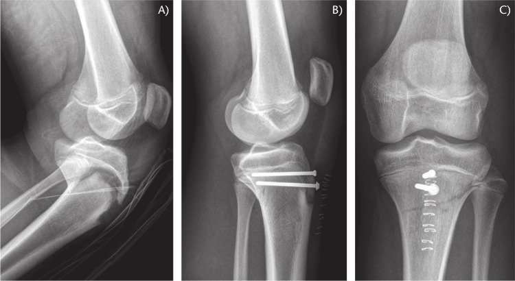 Fig. 11