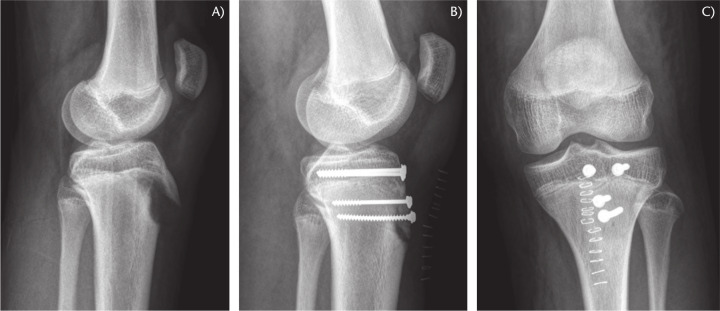 Fig. 13