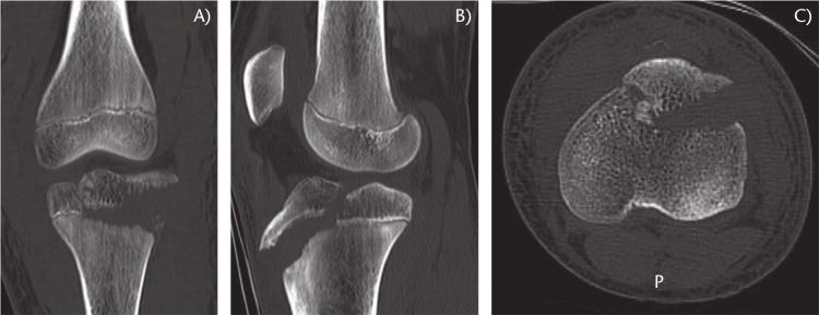 Fig. 9