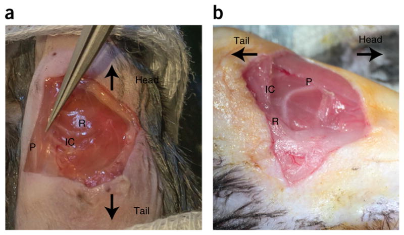 Figure 11