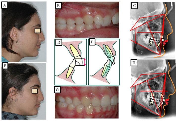 Figure 14