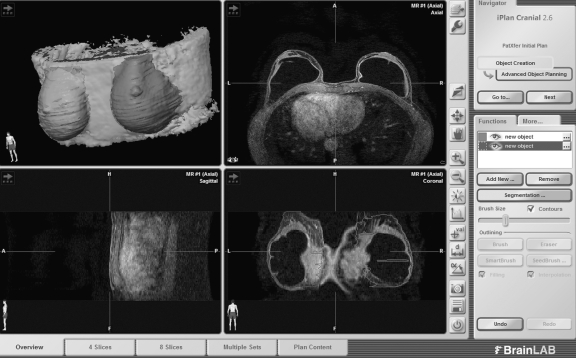 Fig 1