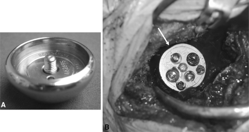 Fig. 3A–B