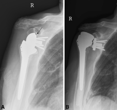 Fig. 1A–B