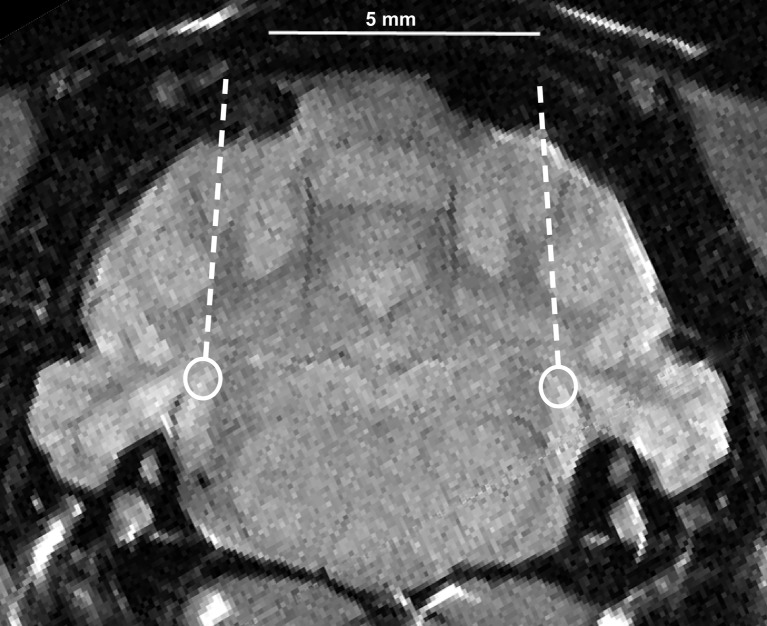 FIG. 1