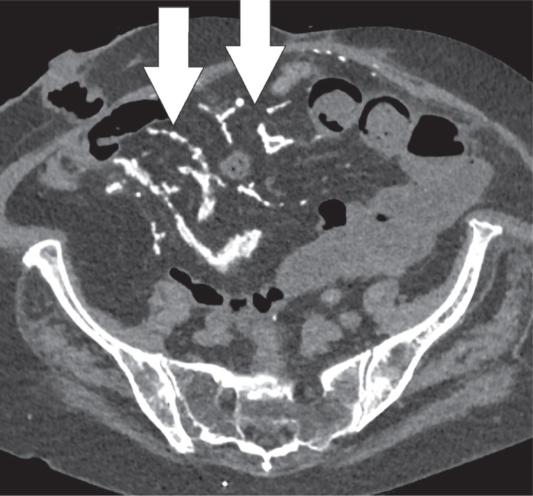 Figure 18