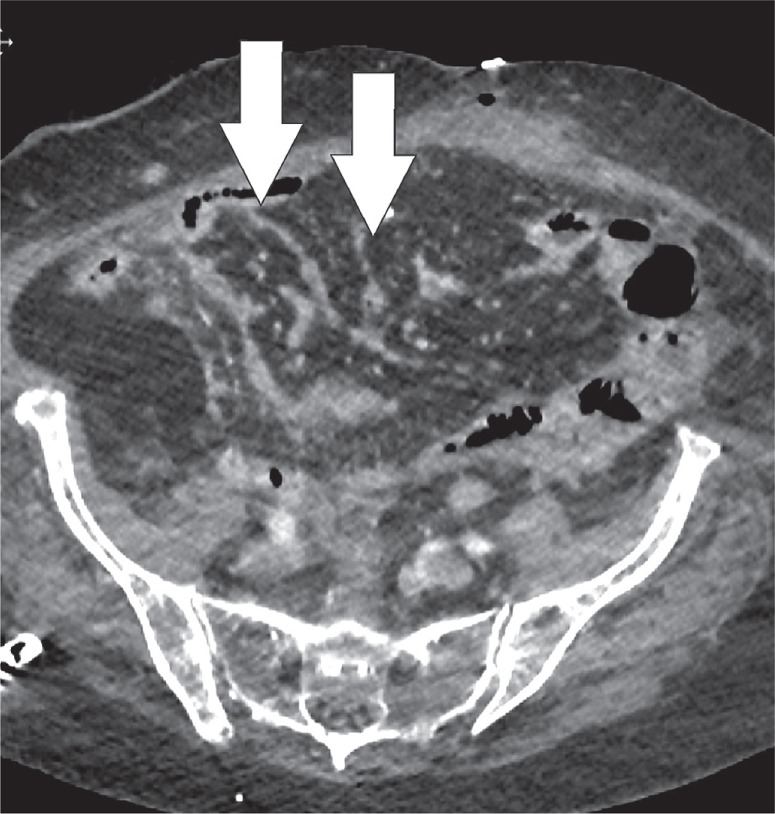 Figure 17