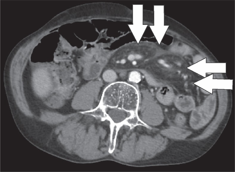 Figure 15