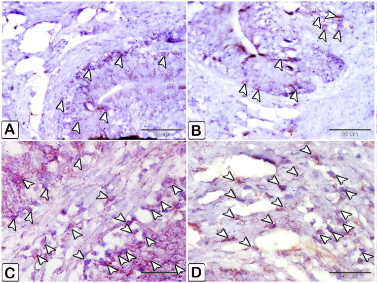 Fig. 18