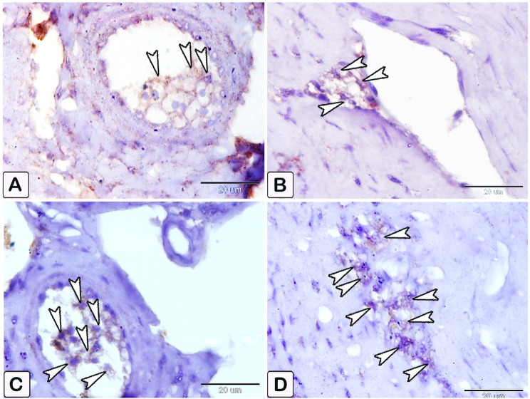 Fig. 19