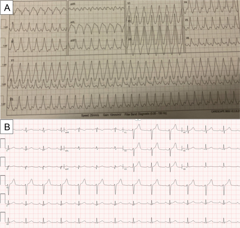 Fig. 1