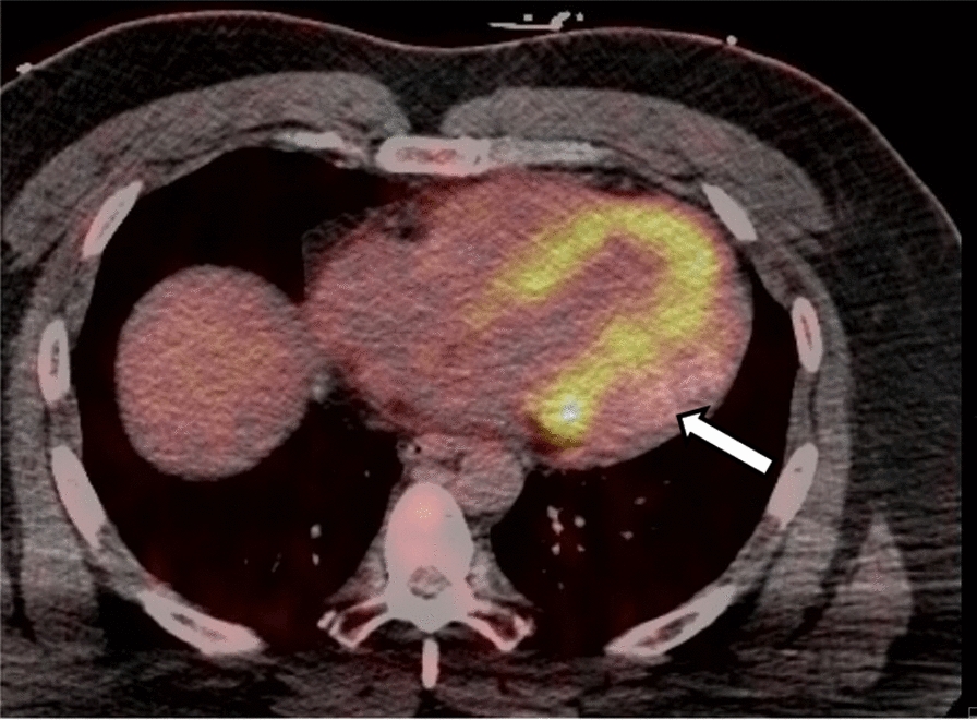 Fig. 5