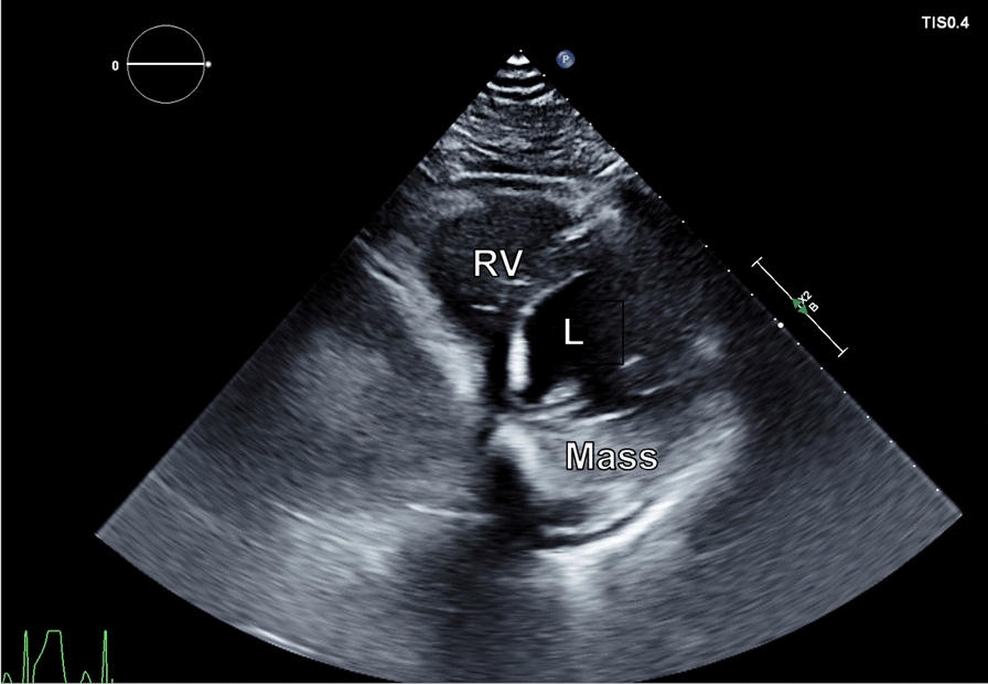 Fig. 2