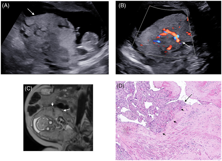 FIGURE 1