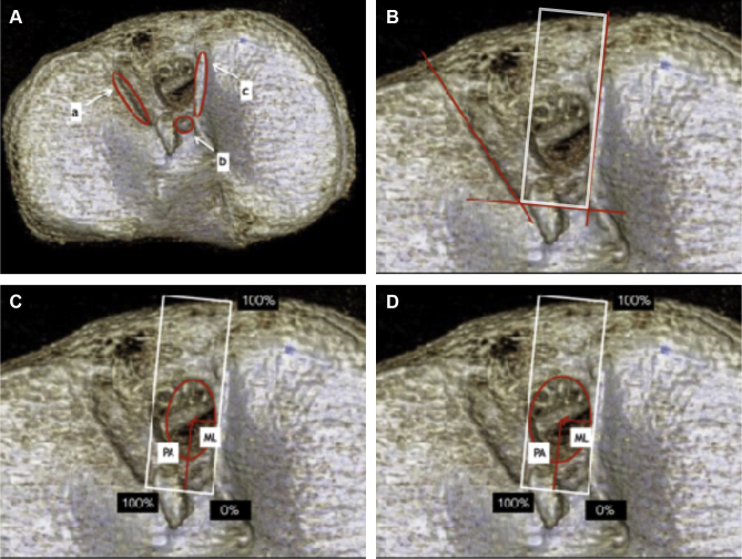 Fig 3