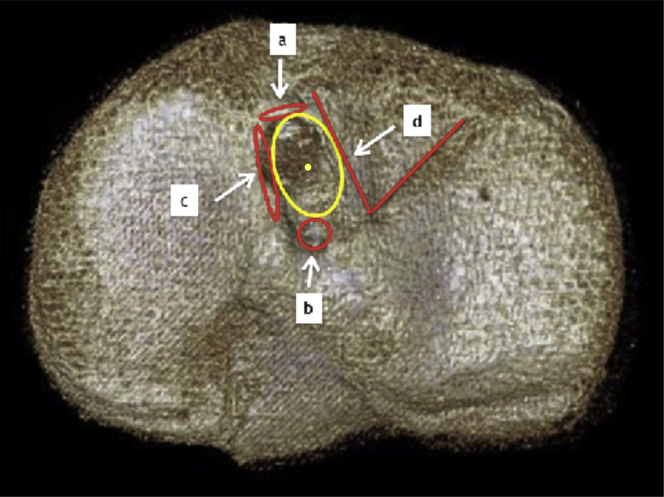 Fig 1