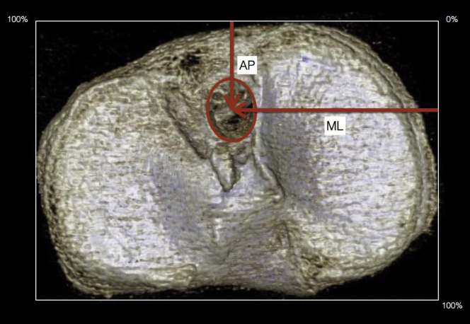 Fig 2