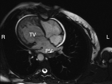 Figure 14