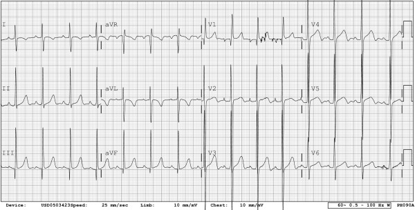 Figure 11