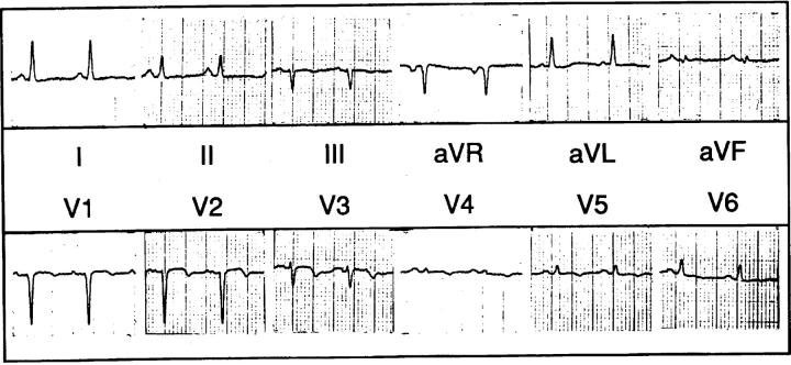 Figure 1  