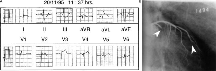 Figure 2  