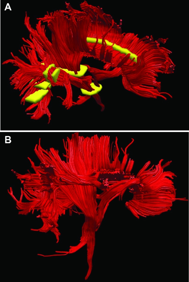 FIGURE 14.