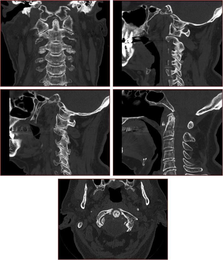 Fig. 7