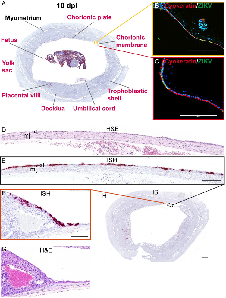 Fig 11