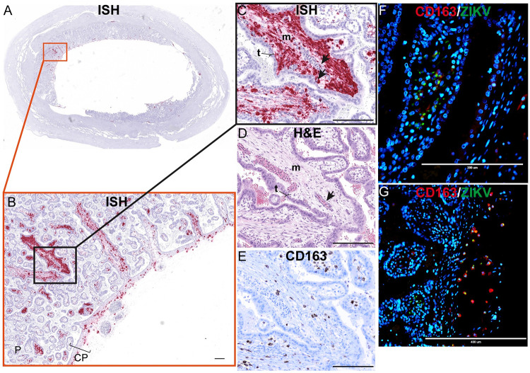 Fig 12