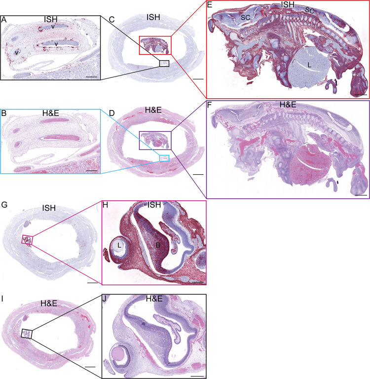 Fig 14