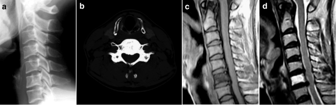 Fig. 2