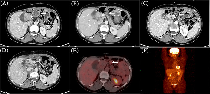 Figure 2