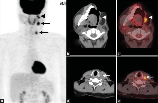 Figure 14