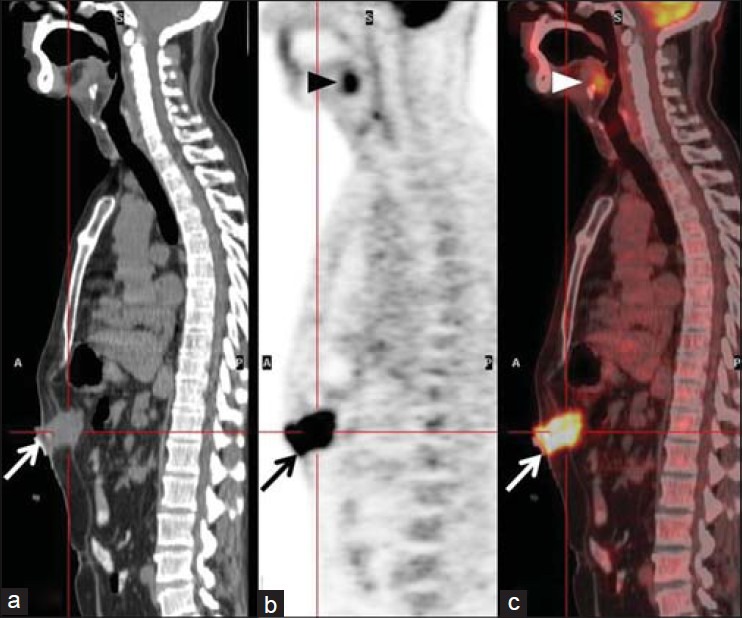 Figure 17