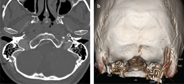 Figure 2. a, b.