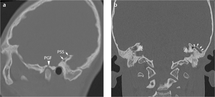 Figure 6. a, b.