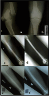 Fig. 4