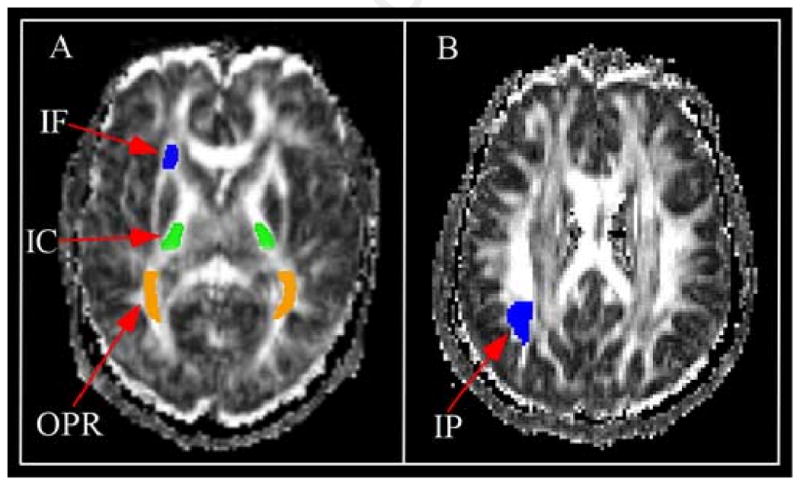 Fig 3