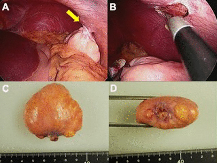 Fig. 2