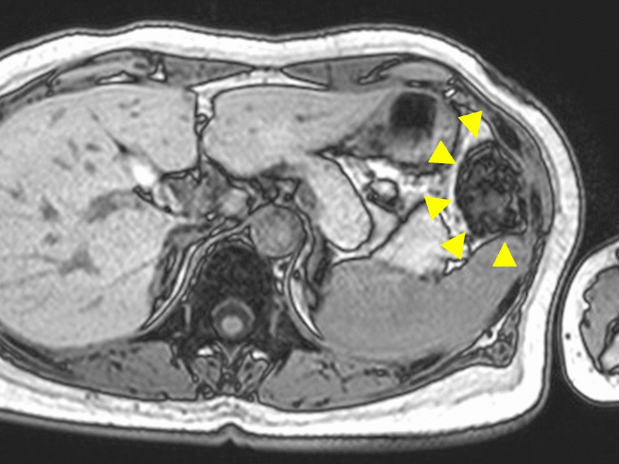 Fig. 1