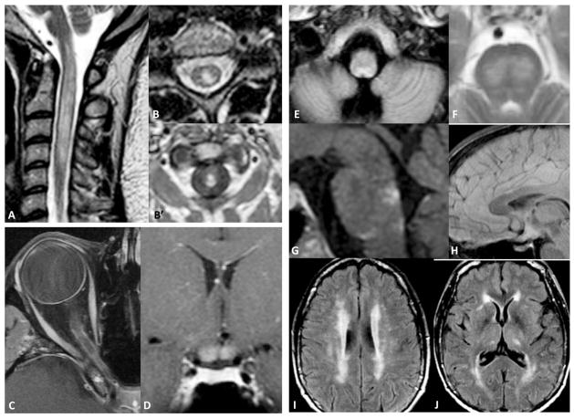 FIG. 1