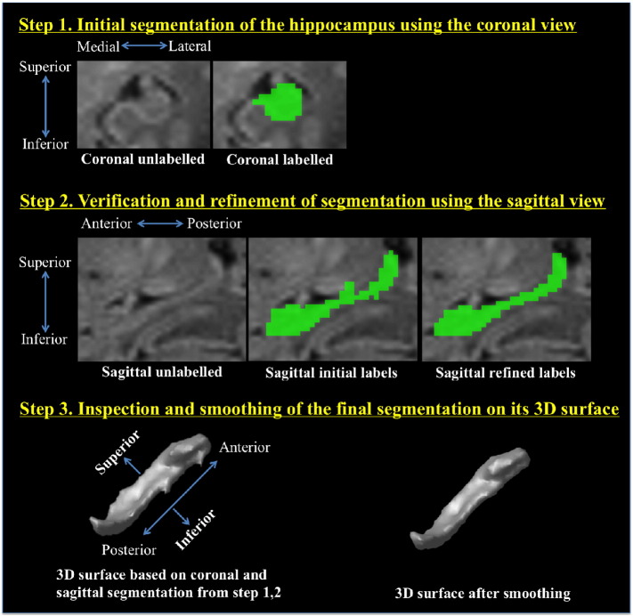 Fig. 2