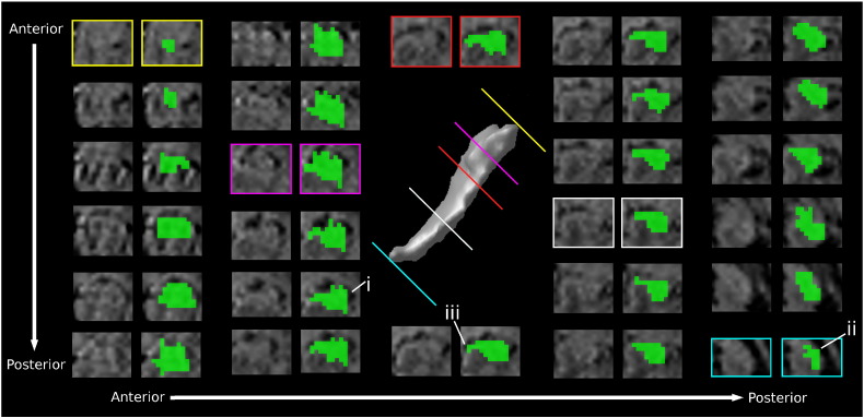 Fig. 3