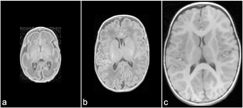 Fig. 1