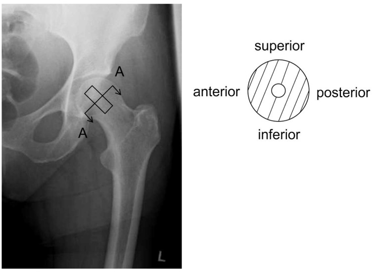 Fig. (1)