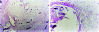 <sc>fig</sc> 3.