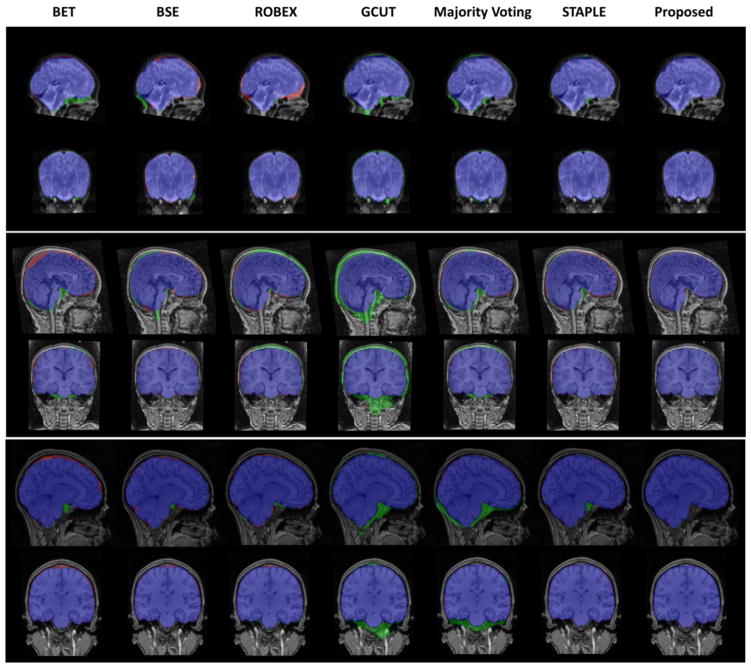 Figure 12