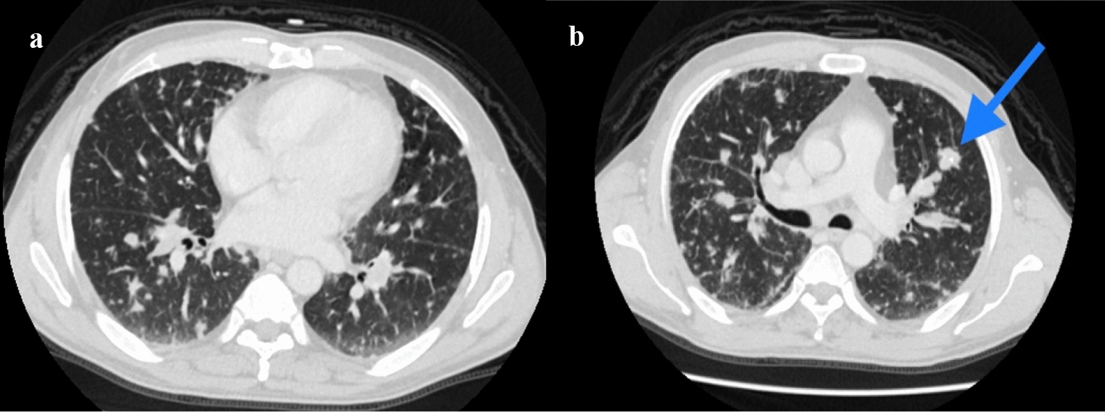 Fig. 2