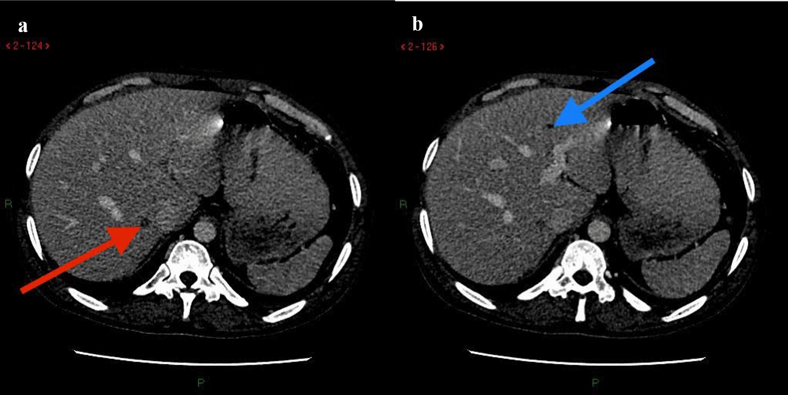 Fig. 3